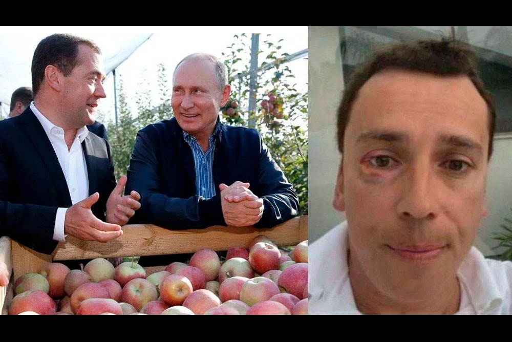 Путин с Медведевым и Галкин с фингалом.