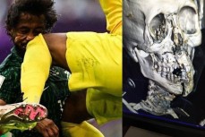 Вратарь Саудовской Аравии сломал челюсть и лицевую кость своему защитнику