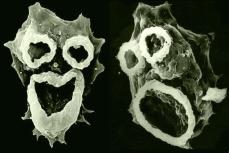 Naegleria fowleri - амеба, пожирающая мозг