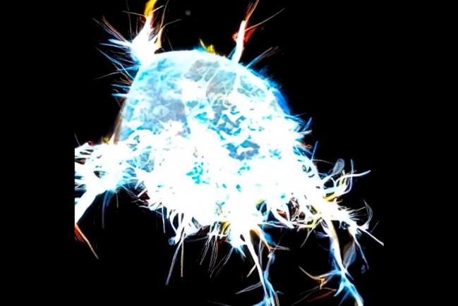Раковые клетки могут передвигаться по организму с помощью «щупалец»