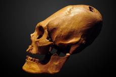 Человеческий череп с удлинённой формой