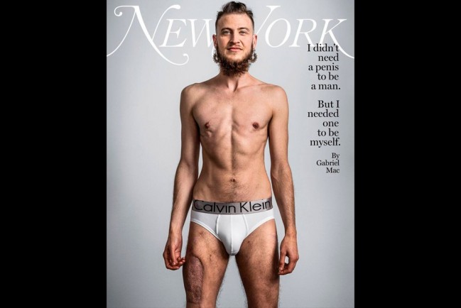 Журнал New York опубликовал на обложке голого трансгендерного мужчину после операции по смене пола 