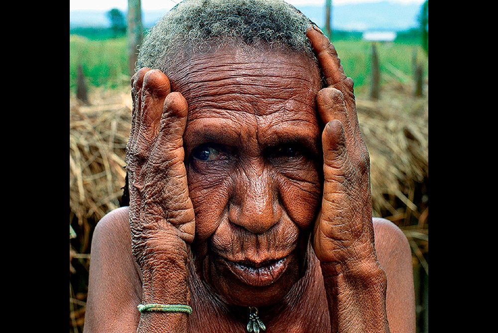 Фаланги скорби в племени дани из Новой Гвинеи. Женщина отрубила почти все пальцы