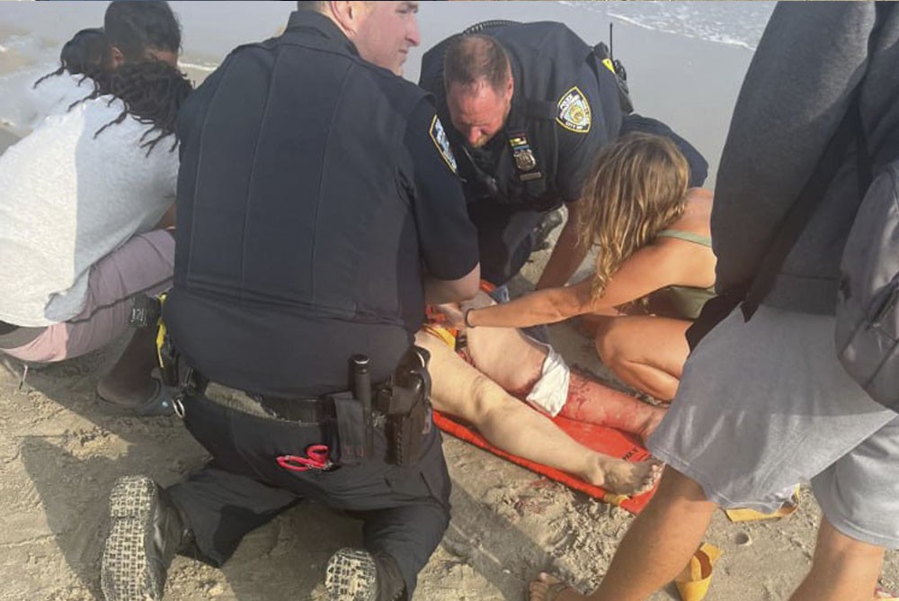 Татьяне Колтунюк оказывают помощь после нападения акулы на пляже Нью-Йорке