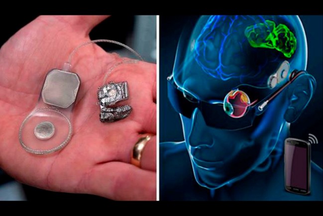 Бионический протезы глаз скоро будут доступны людям, обреченным на слепоту