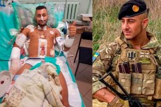 Британский наёмник изувечен в боях с армией России: лишился частей руки и ноги